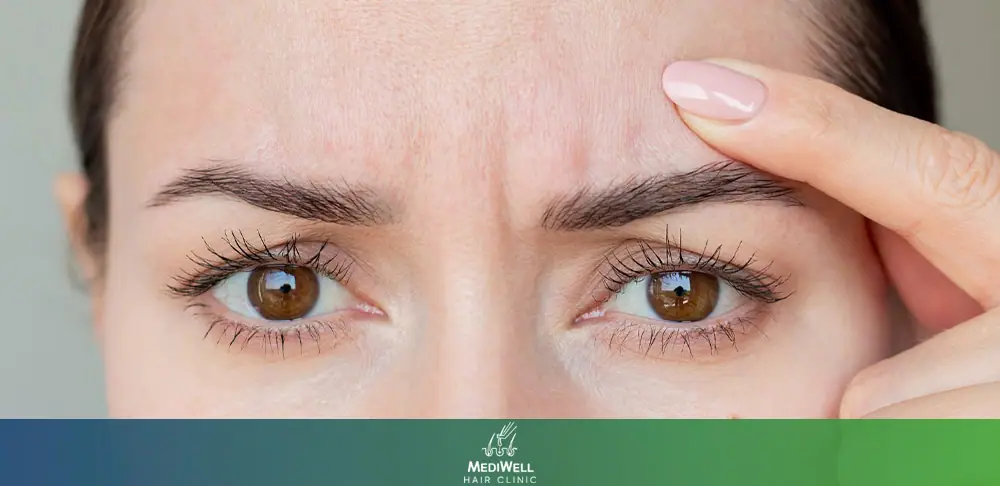 Can Over-Plucked Eyebrows Grow Back?