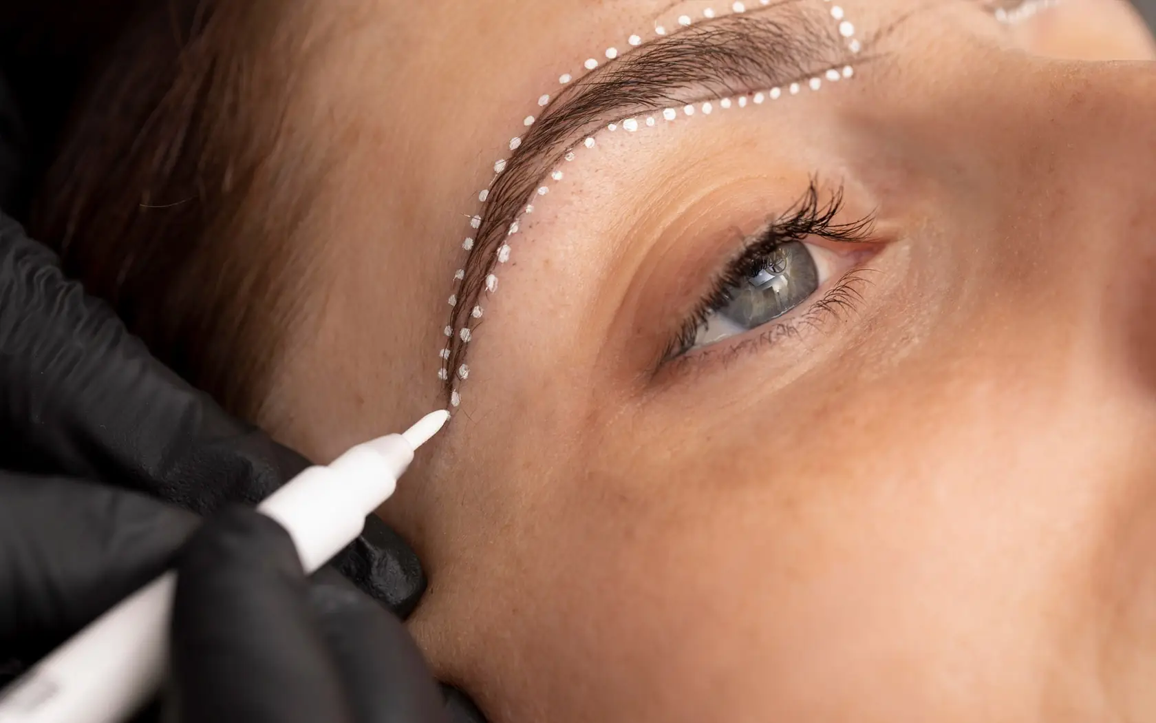 Eyebrow Transplant Techniques