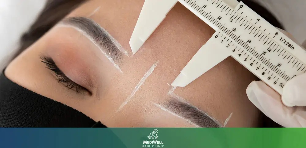 Eyebrow Transplant for Women
