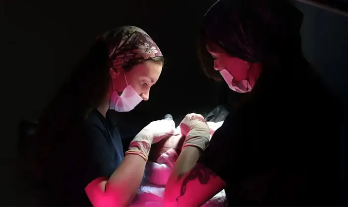 FUE Hair Transplant