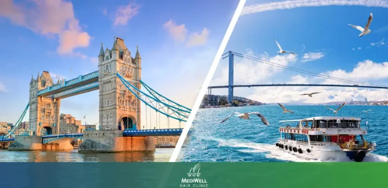 Hair Transplant Turkey Cost vs London Which is Better for You