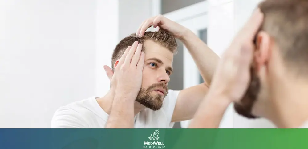 How long does a hair transplant last?