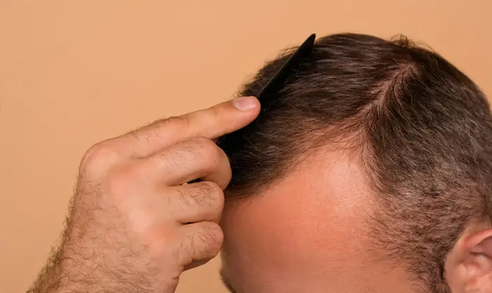 London Hair Transplant Clinic Hybrid