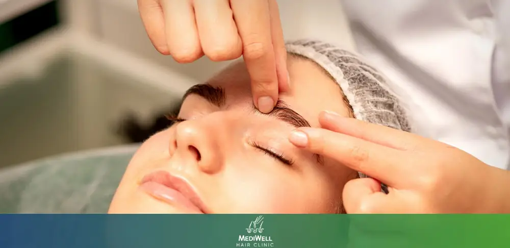 Long-Term Maintenance is Part of a Successful Eyebrow Transplant