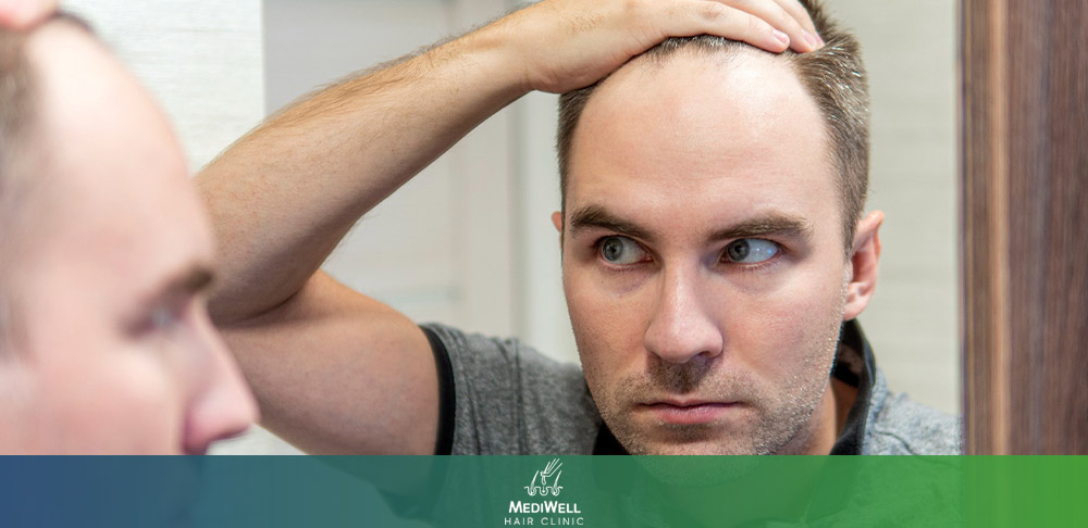Why Hairline Design Matters