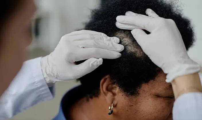 afro hair transplant clinic in london